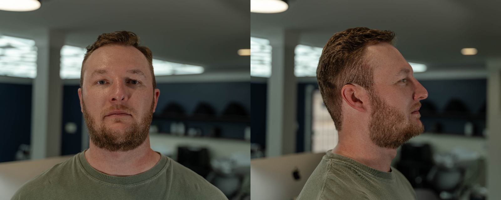 Mens haircut and beard trim front and side view at Cherry Barbers top rated barbershop Denver Colorado